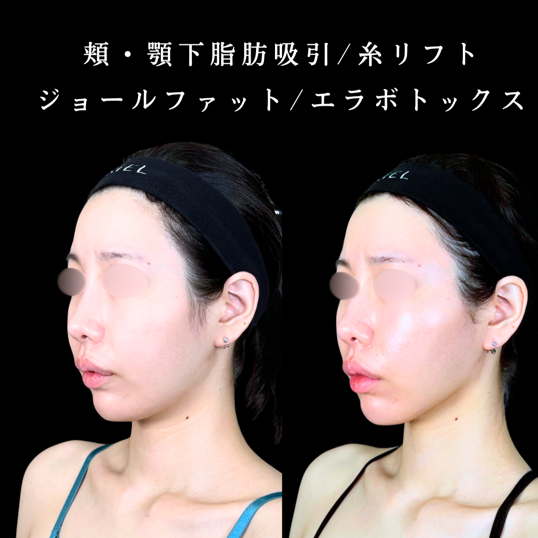 No.20265の症例写真2