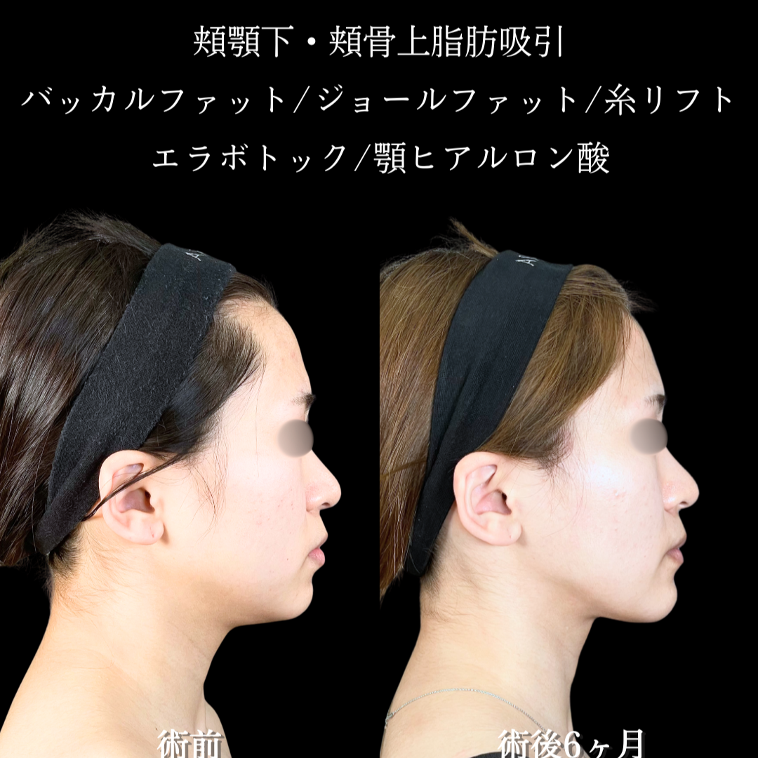 No.20283の症例写真2