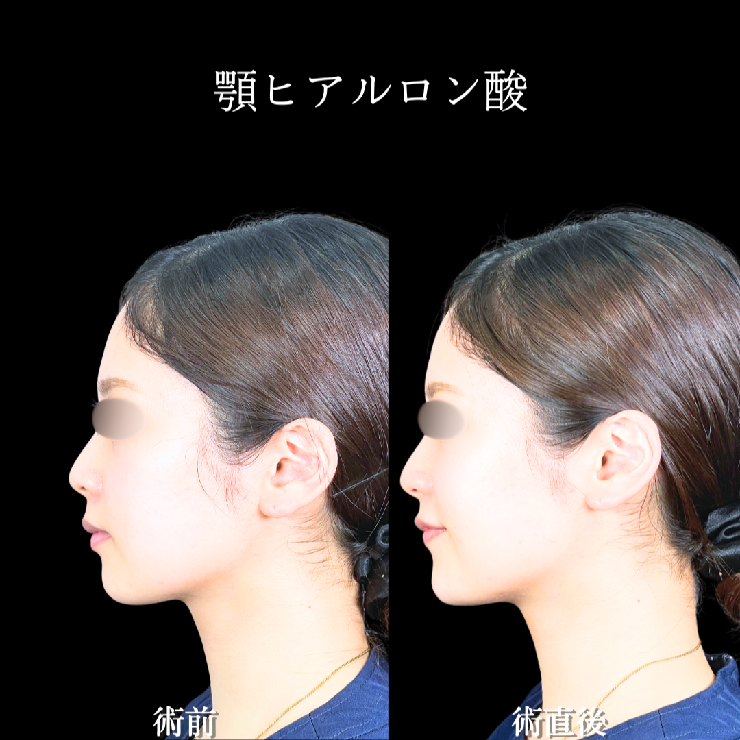 No.20140の症例写真2