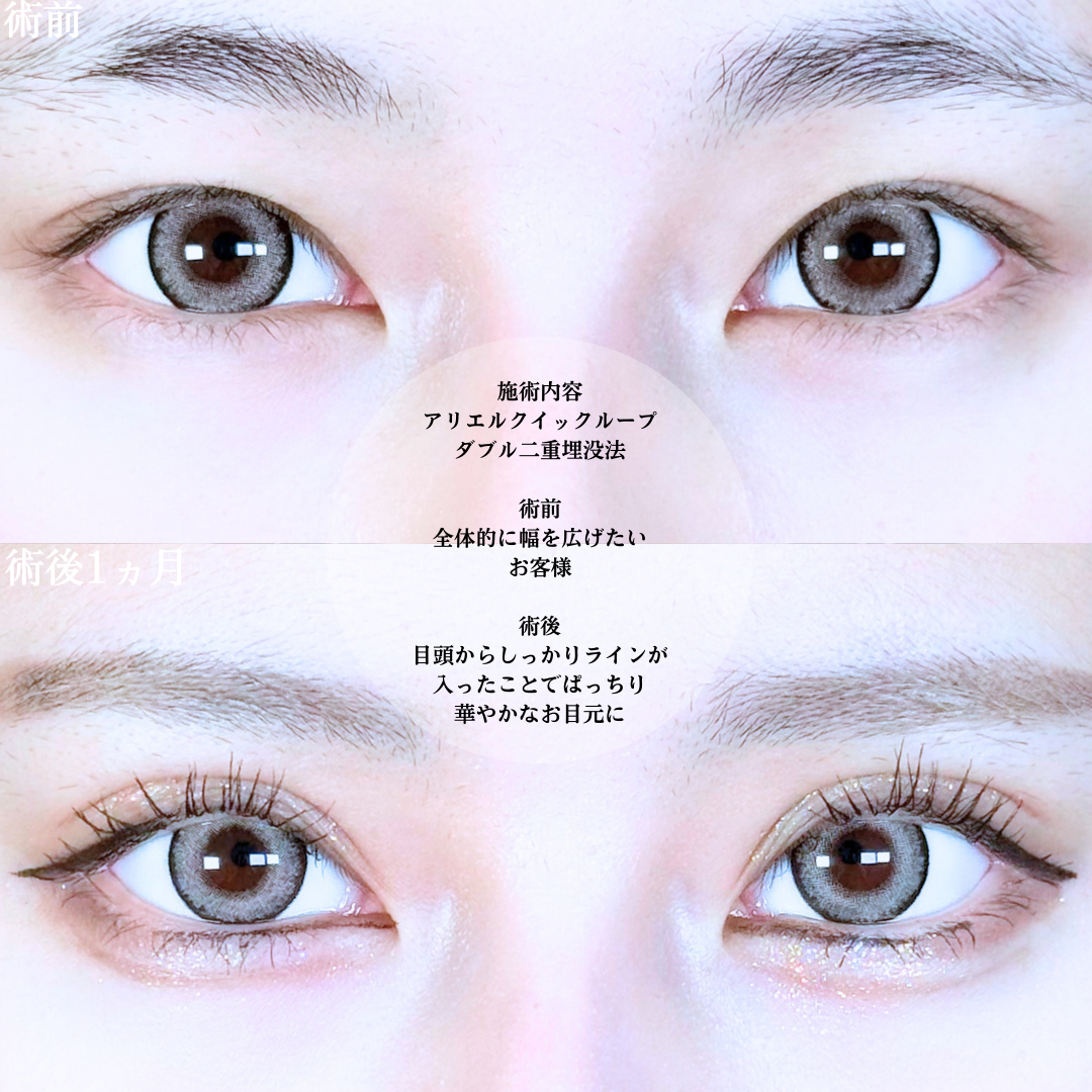 No.20226の症例写真1