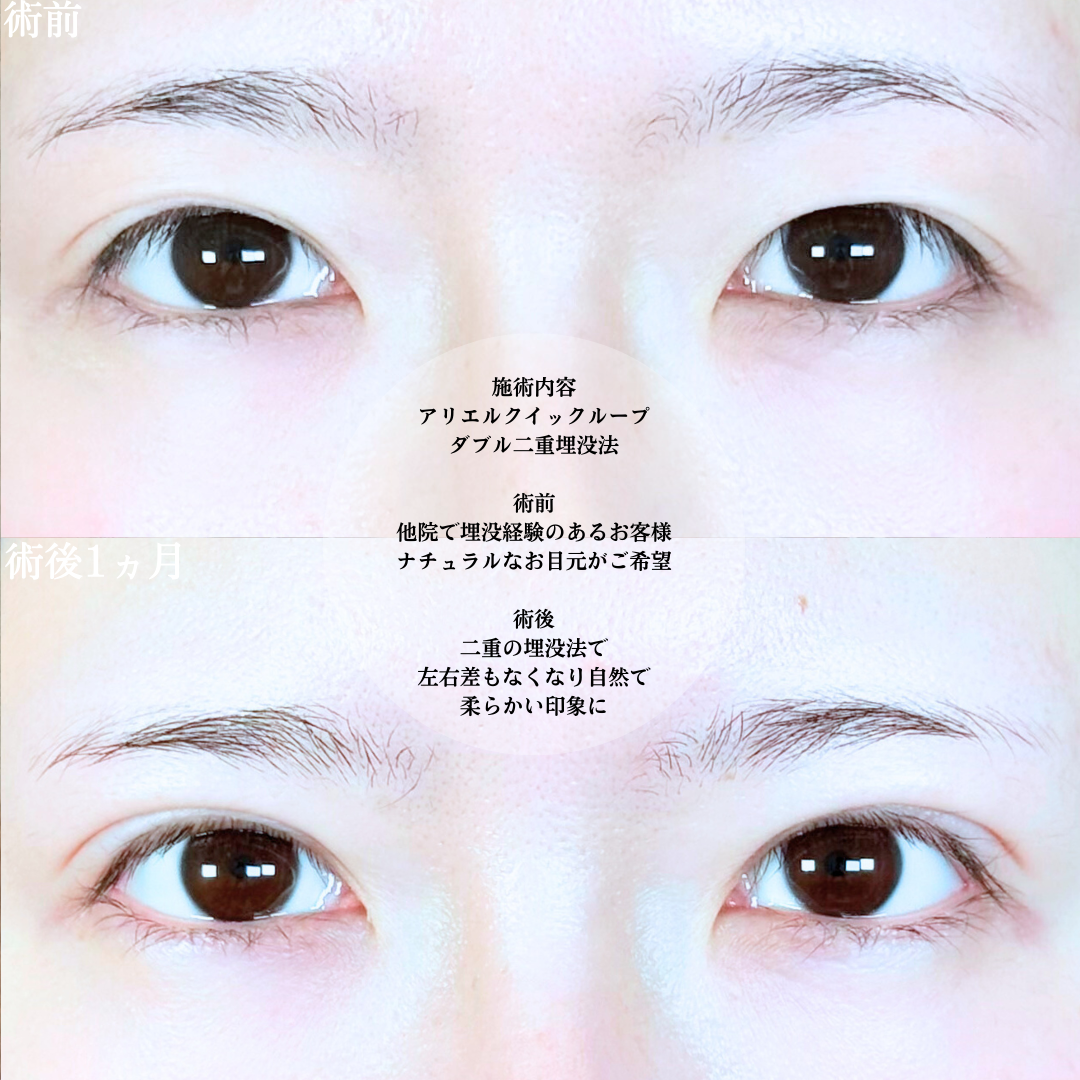 No.20290の症例写真1