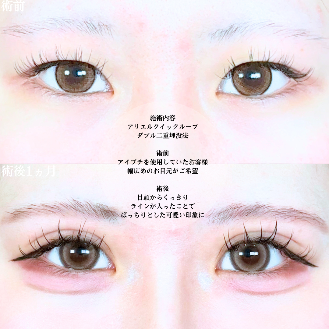 No.20382の症例写真1