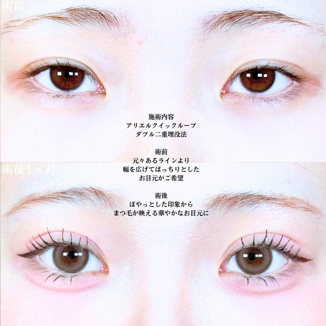 No.20503の症例写真1