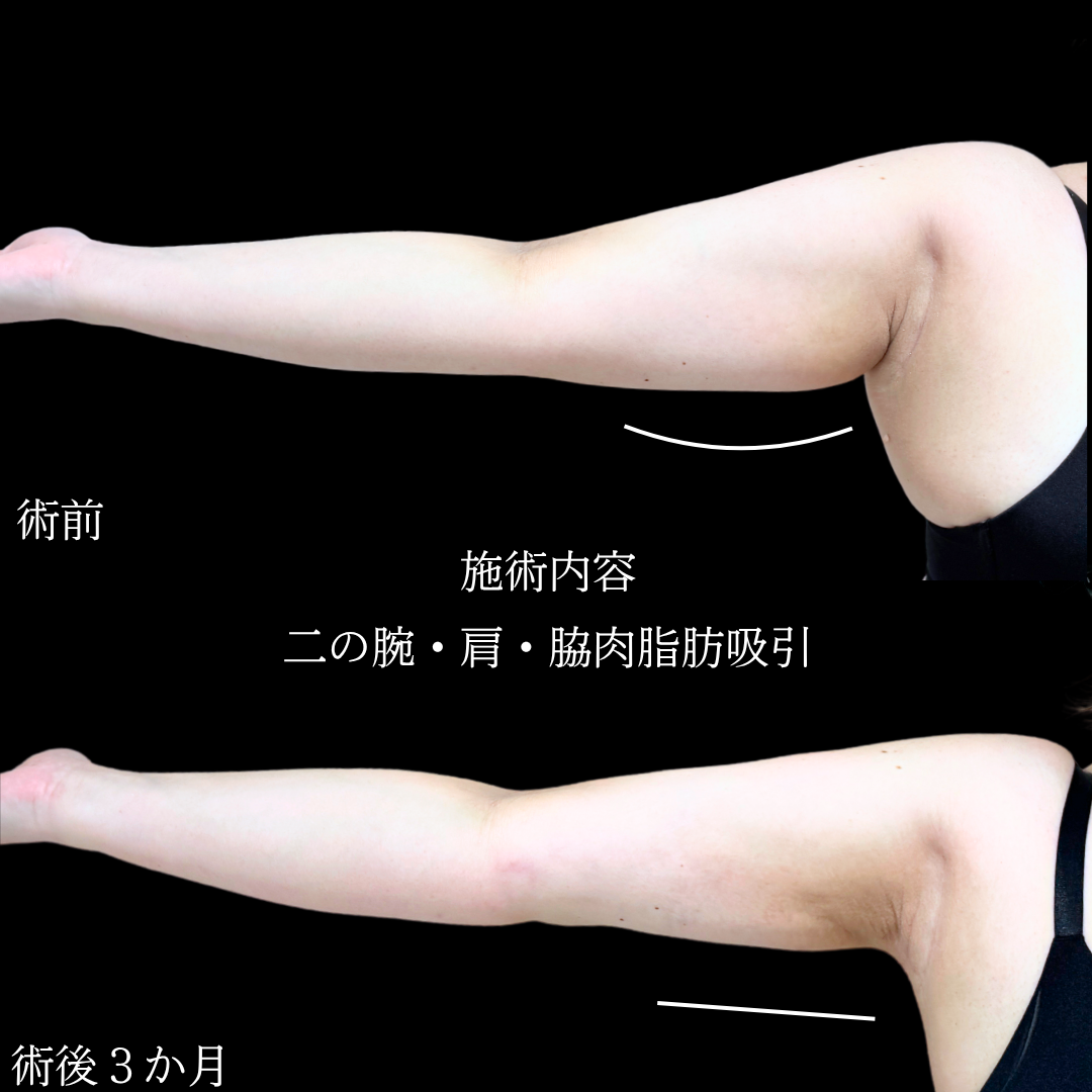 No.20543の症例写真1