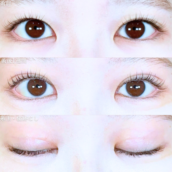 No.20147の症例写真