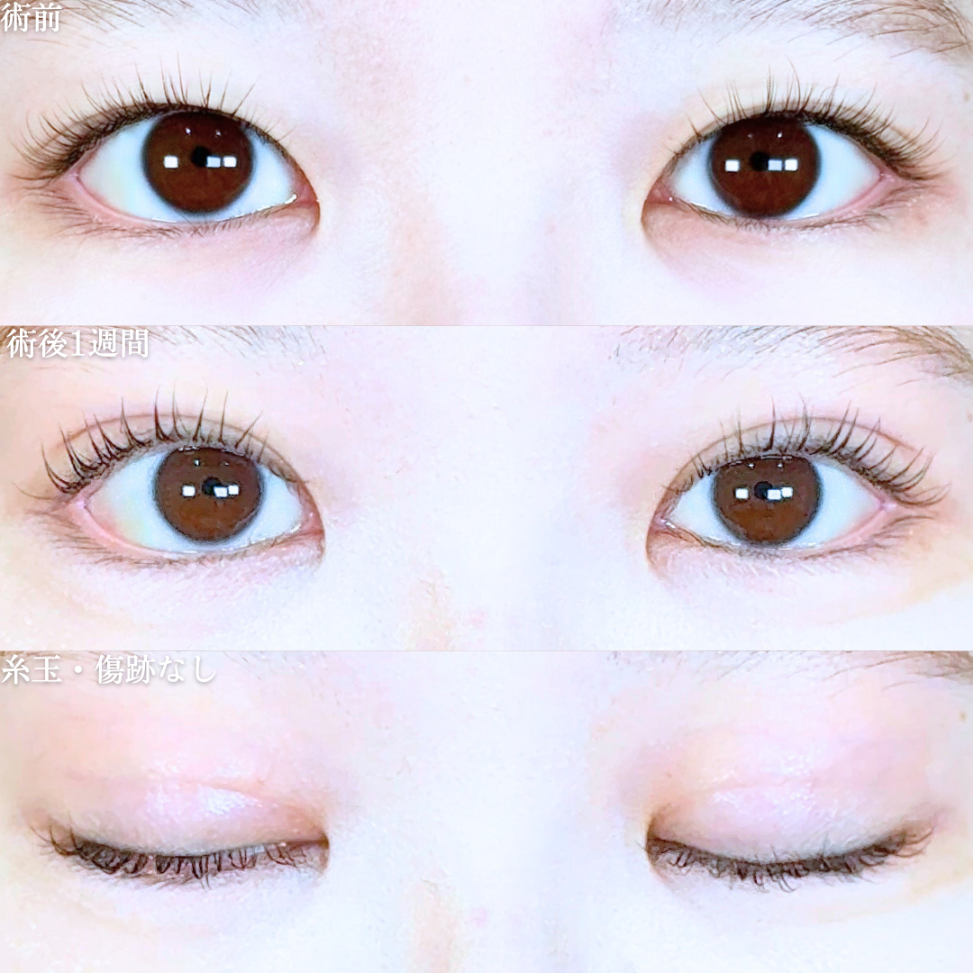 No.20147の症例写真