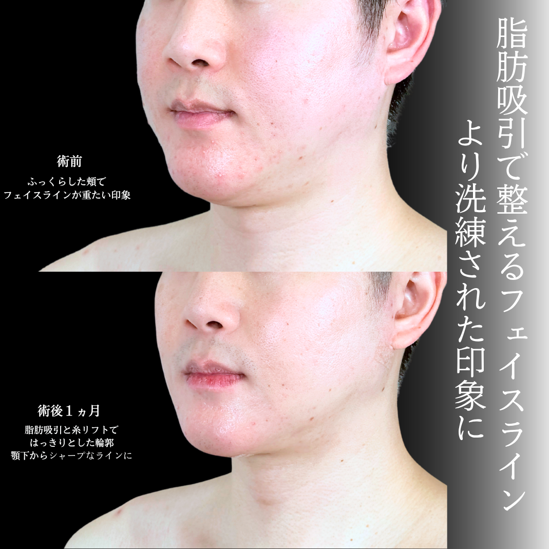 No.20551の症例写真1