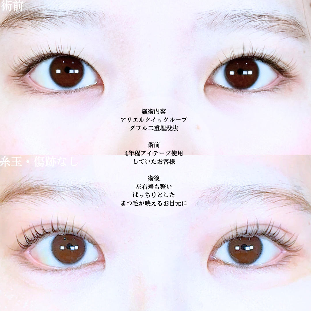 No.20147の症例写真1