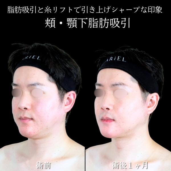 No.20551の症例写真