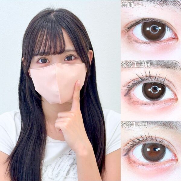 No.20232の症例写真