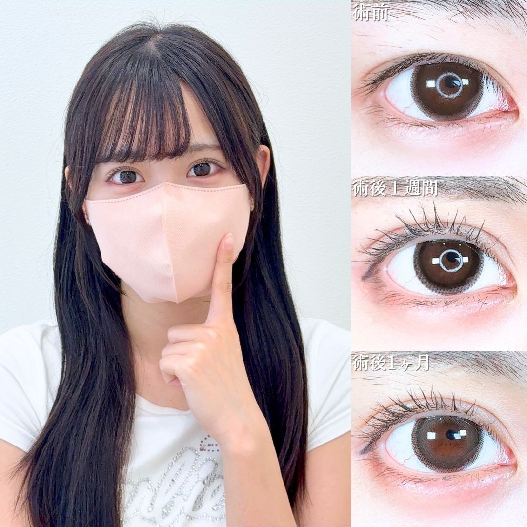 No.20232の症例写真