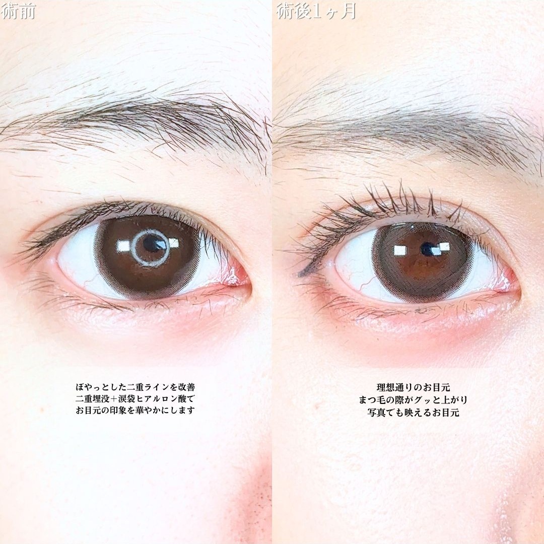 No.20232の症例写真1