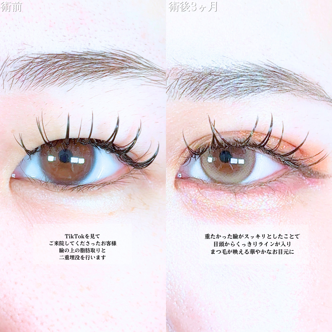 No.20246の症例写真1