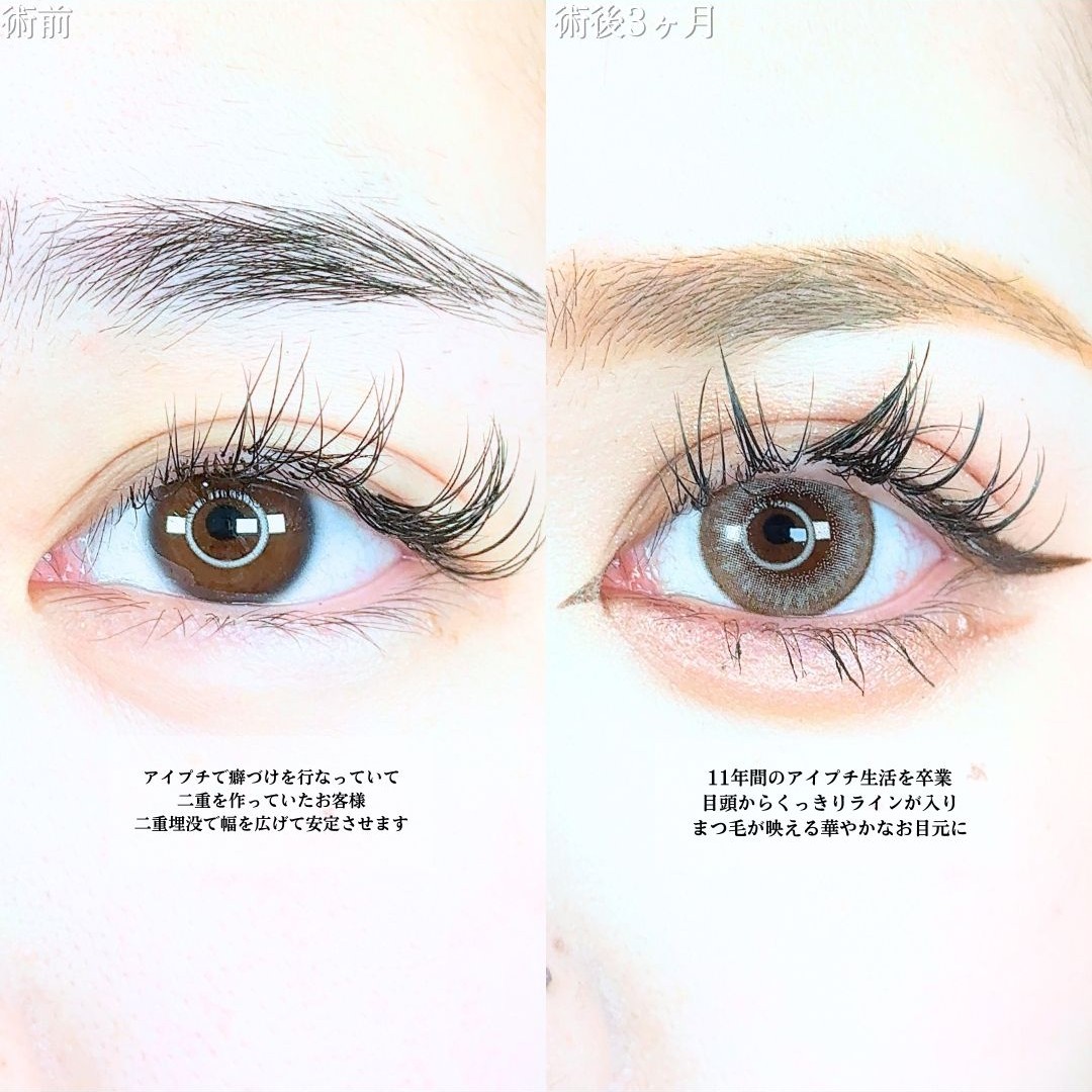 No.20325の症例写真1