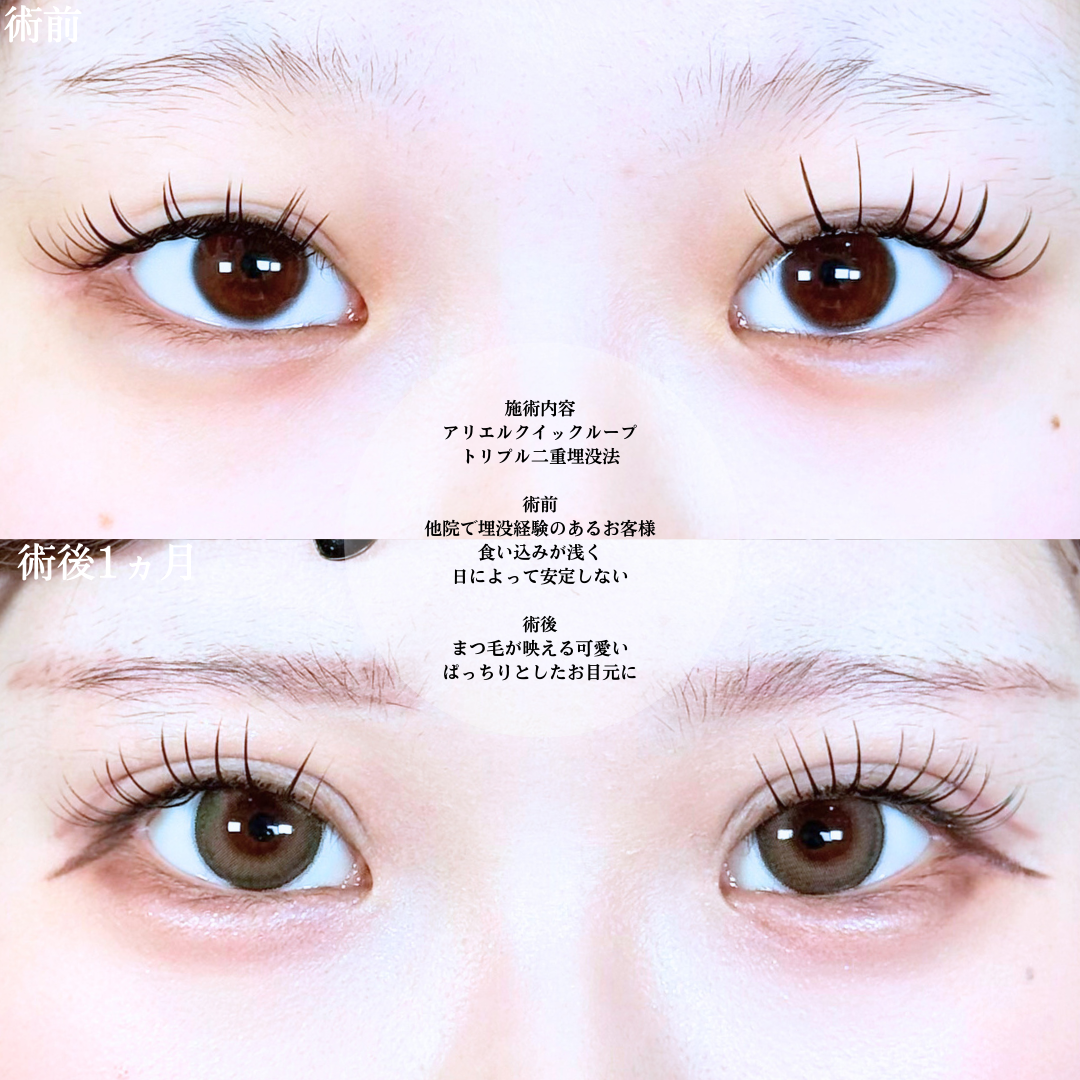 No.20334の症例写真1