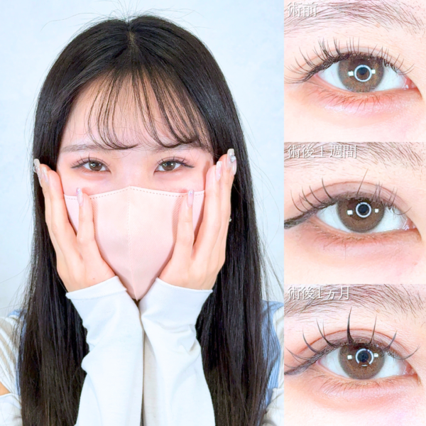 No.20507の症例写真