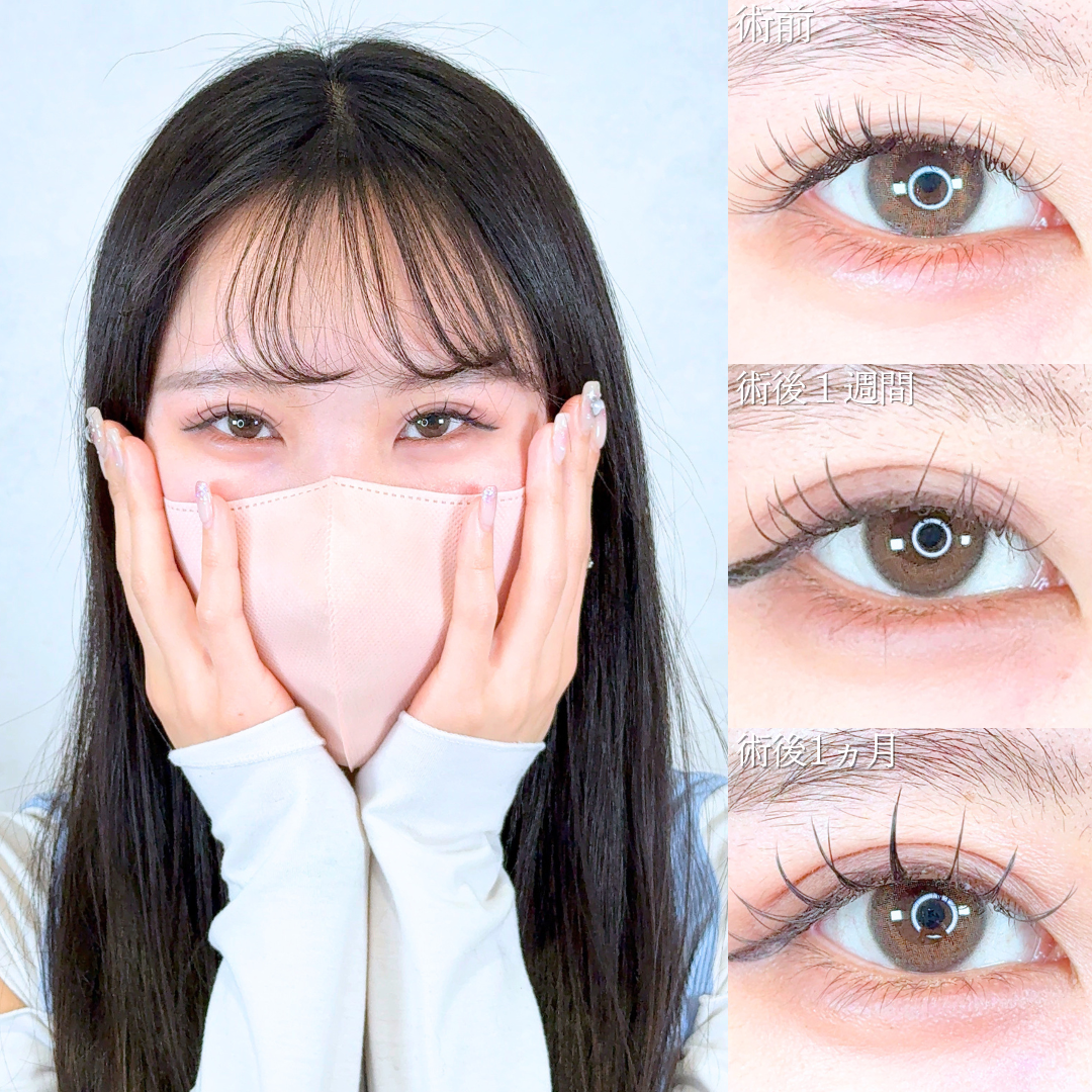 No.20507の症例写真