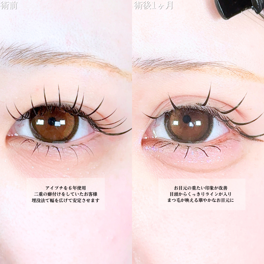 No.20513の症例写真1