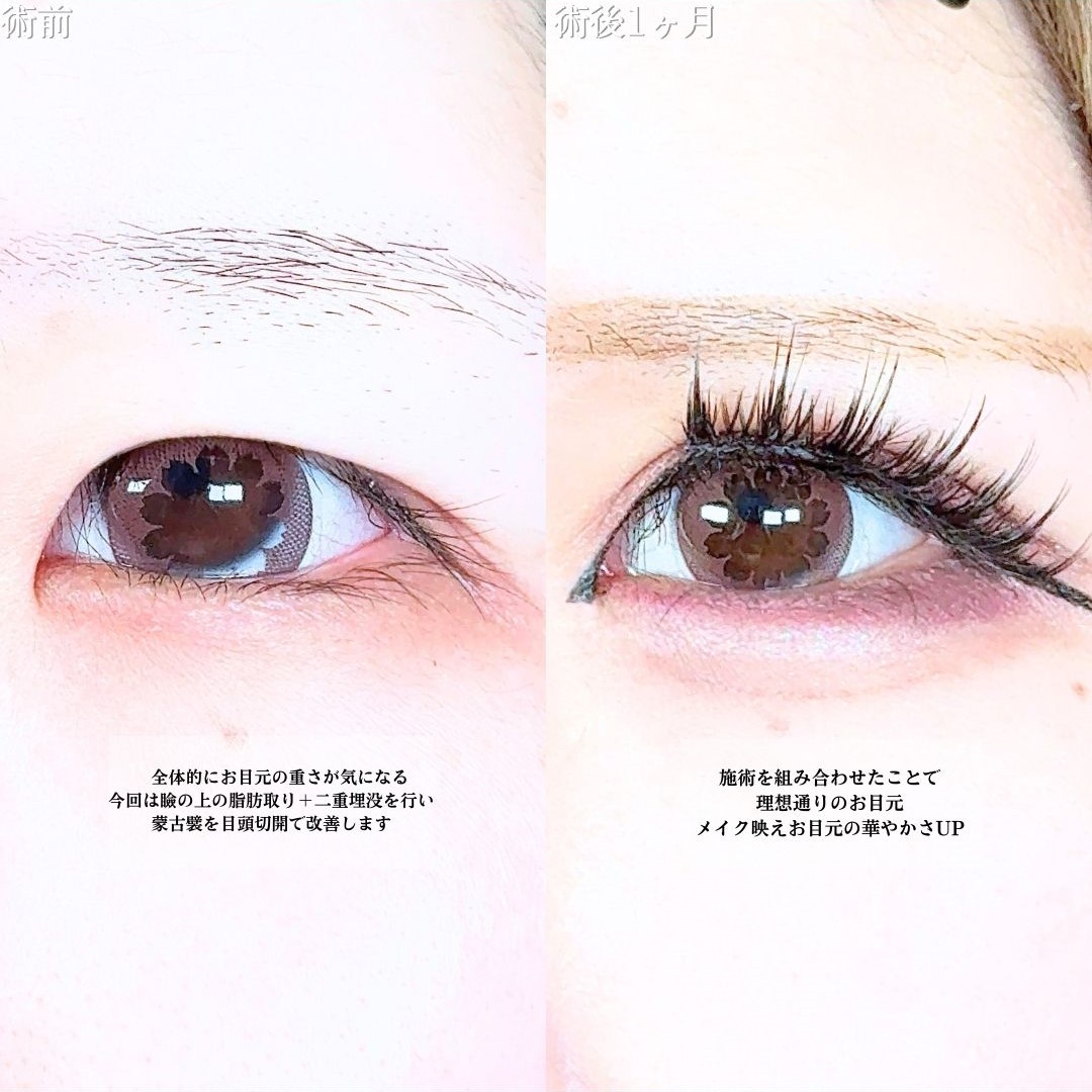 No.20153の症例写真1