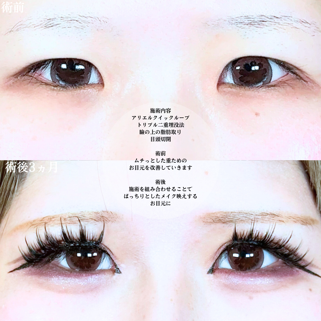 No.20167の症例写真1