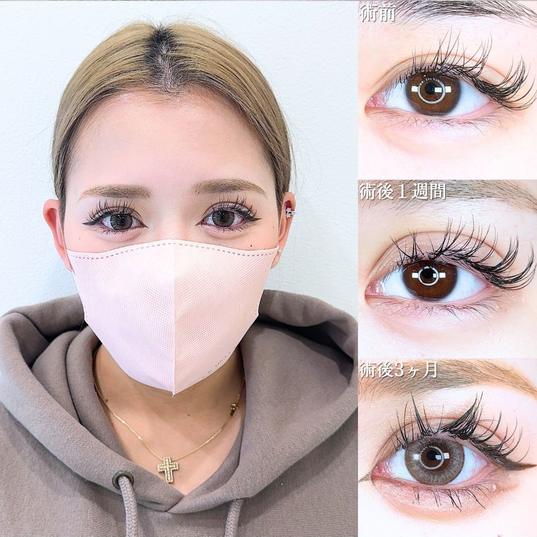 No.20325の症例写真