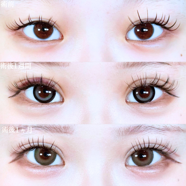 No.20334の症例写真 No.20334の症例写真