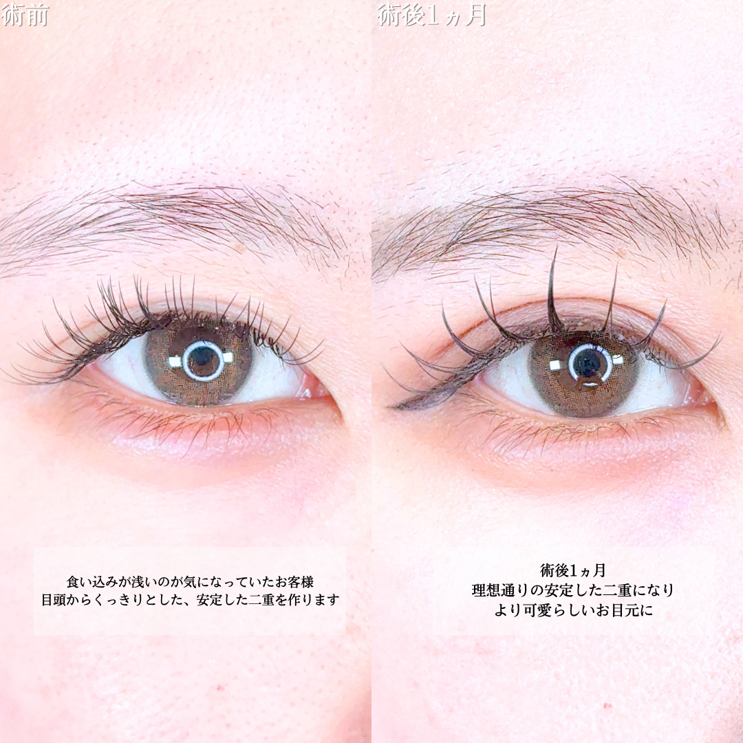 No.20507の症例写真1