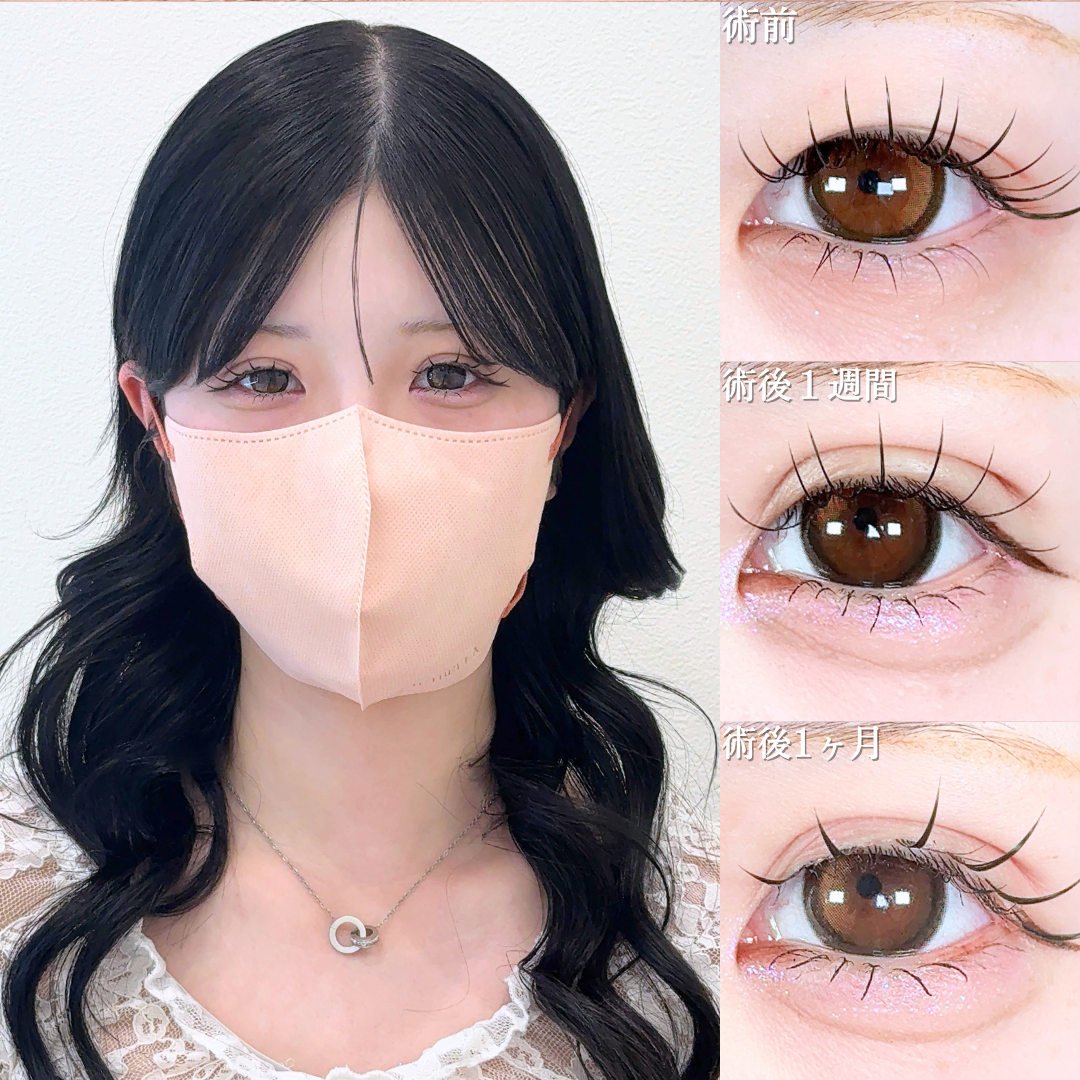 No.20513の症例写真