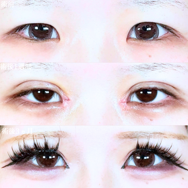 No.20167の症例写真