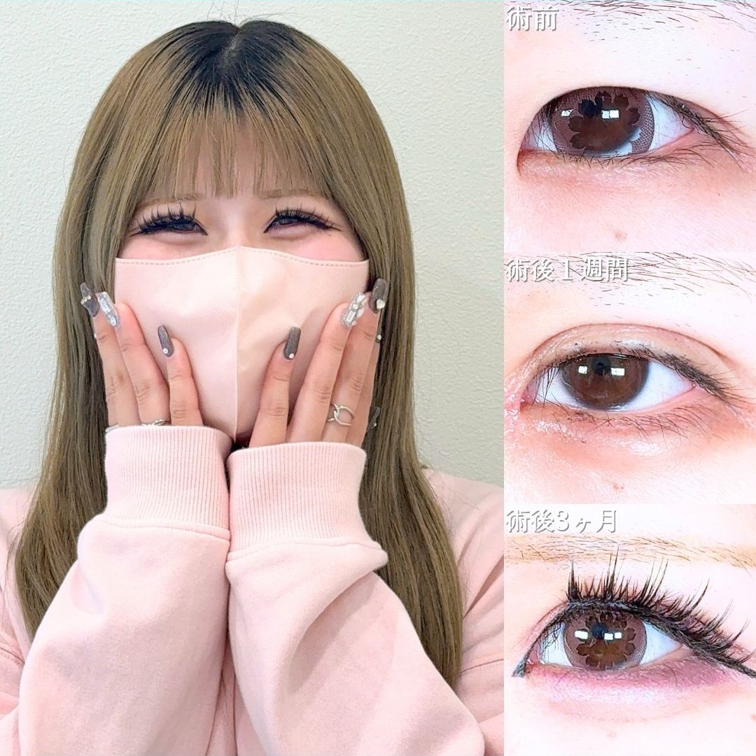 No.20153の症例写真