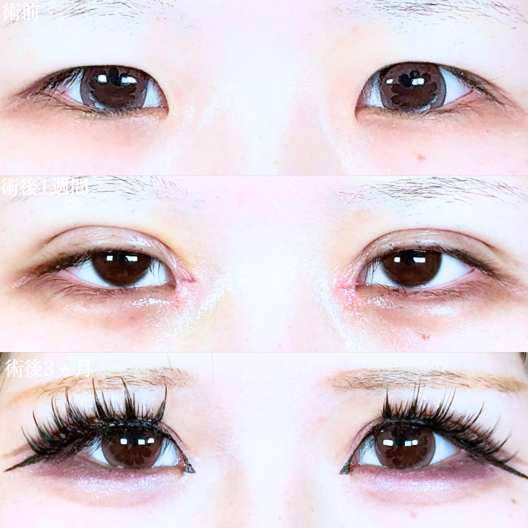 No.20167の症例写真