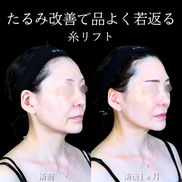 No.20656の症例写真