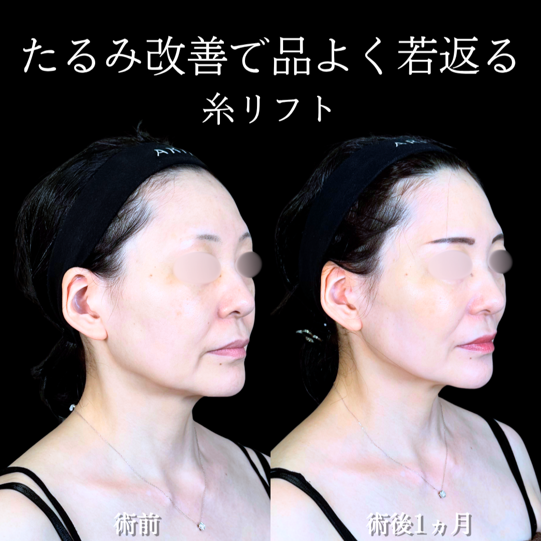 No.20656の症例写真