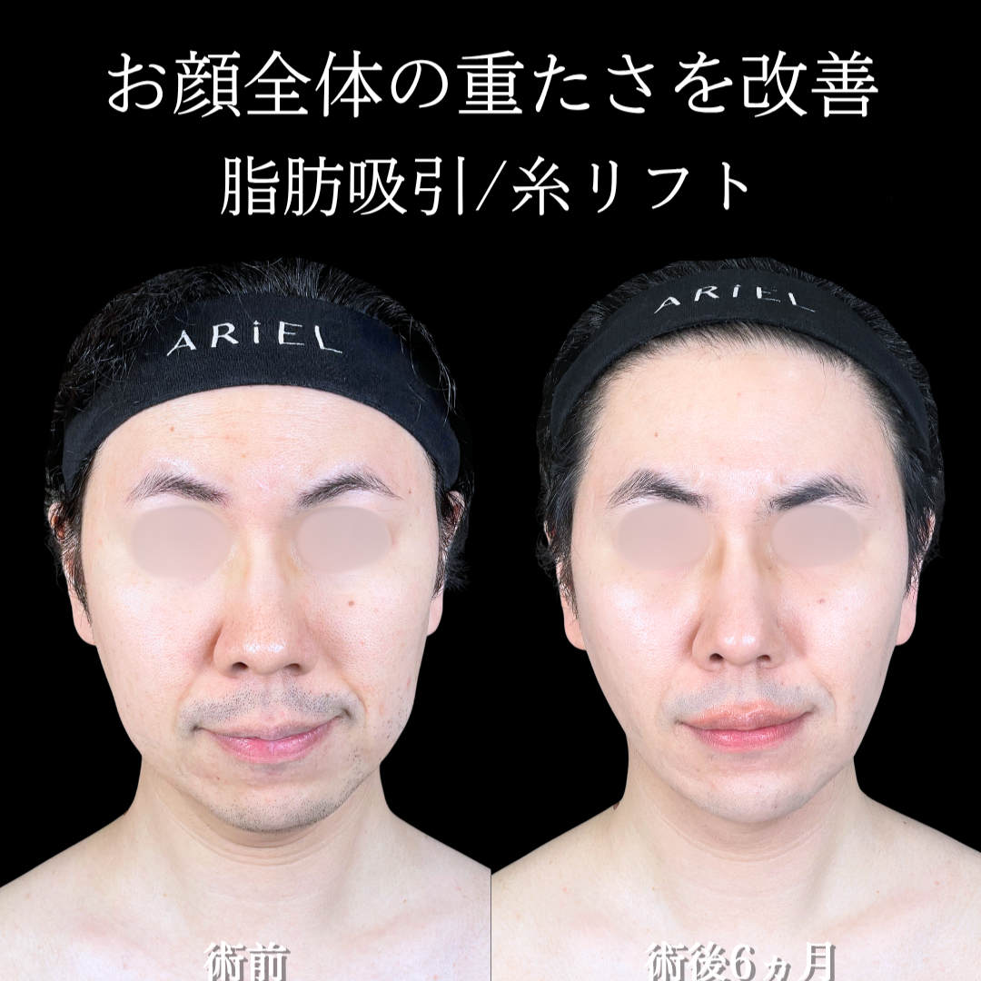 No.20775の症例写真