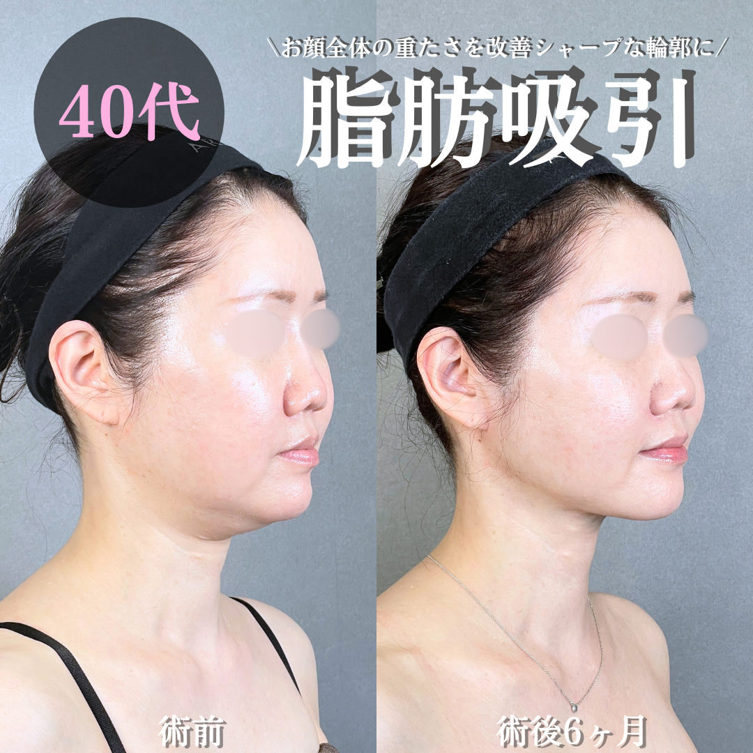 No.20783の症例写真