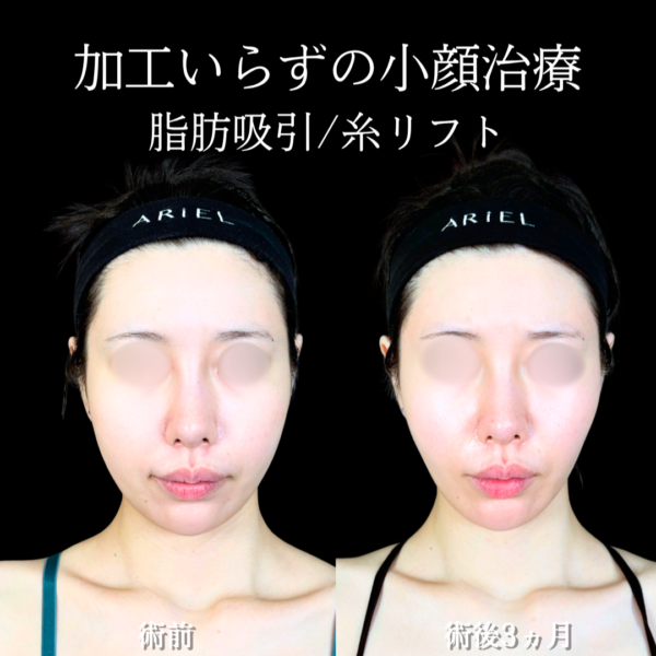 No.20805の症例写真