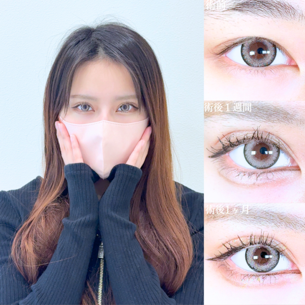 No.20820の症例写真