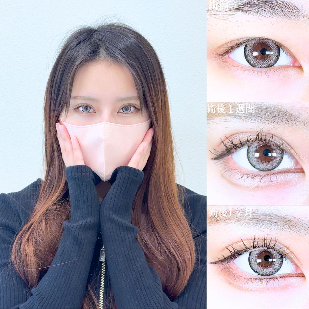 No.20820の症例写真