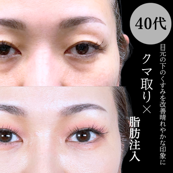 No.20833の症例写真