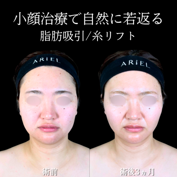 No.20840の症例写真