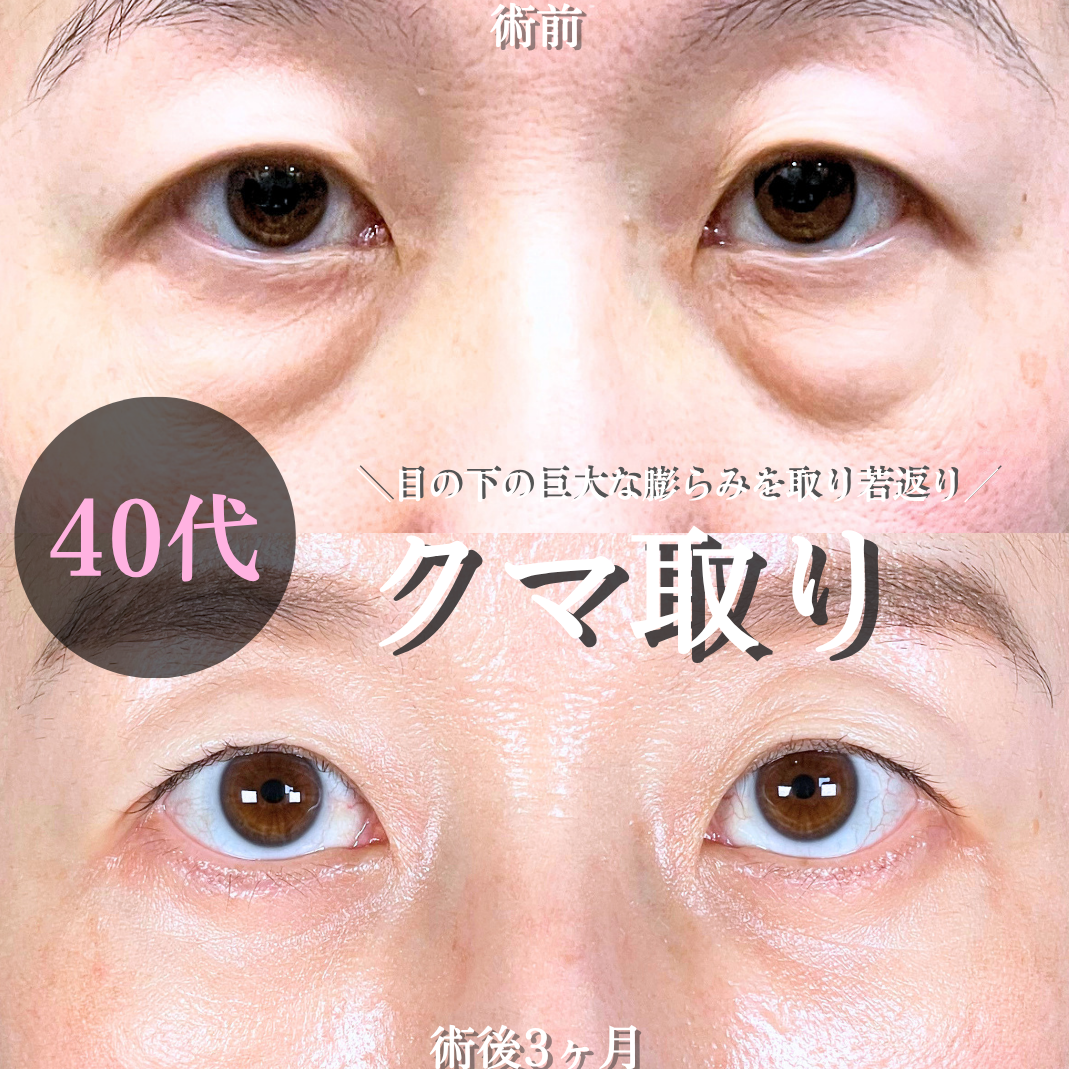 No.20856の症例写真