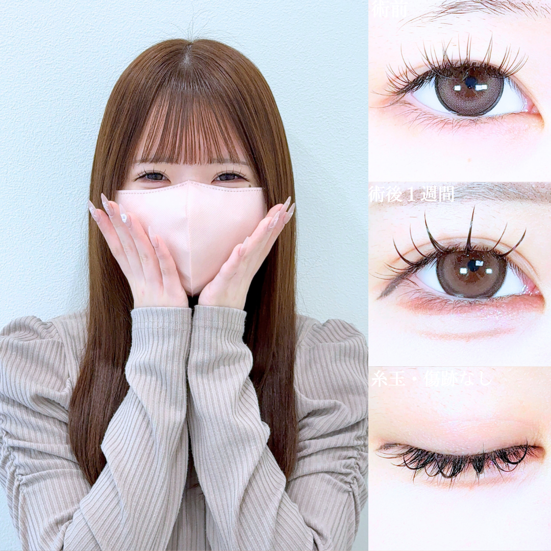 No.20878の症例写真