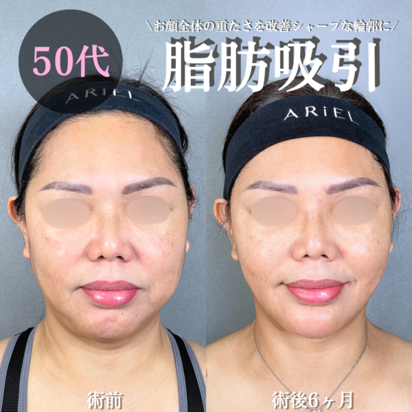 No.20876の症例写真