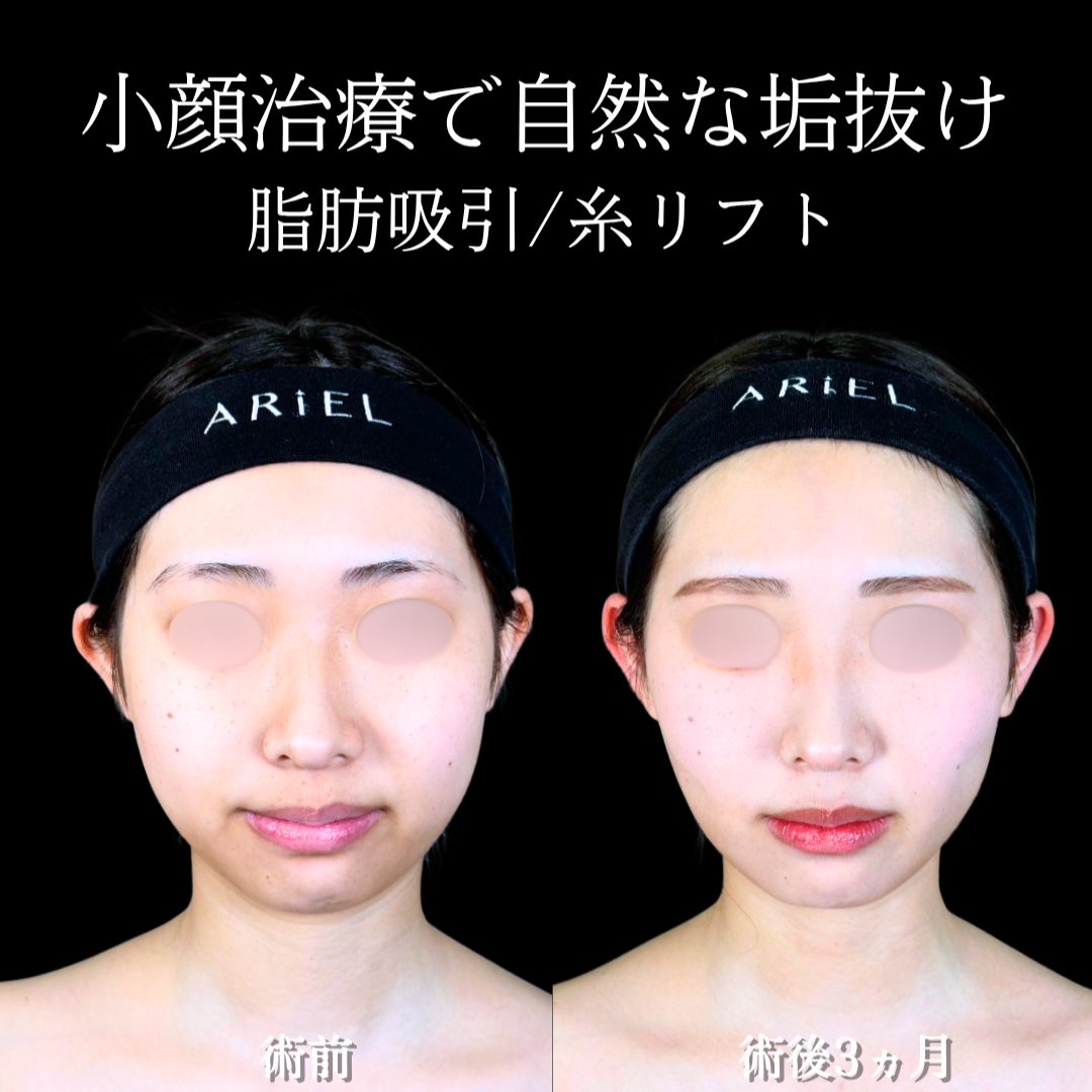 No.20894の症例写真