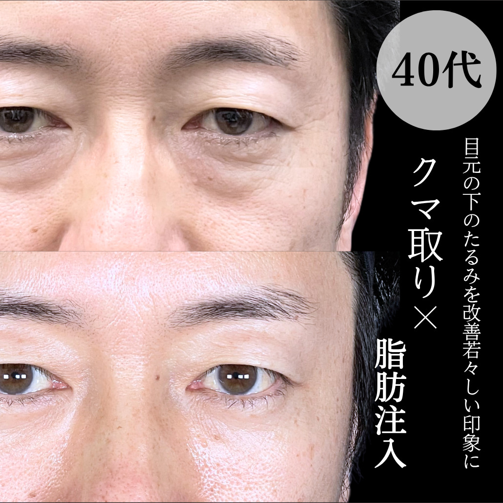 No.20916の症例写真