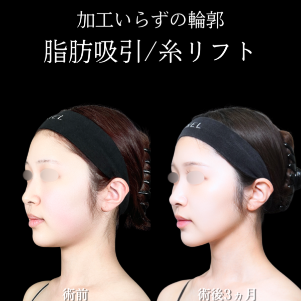 No.21006の症例写真