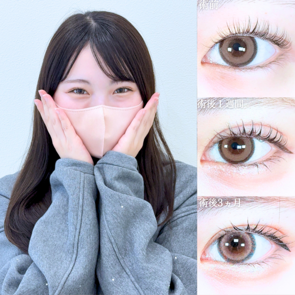 No.21021の症例写真