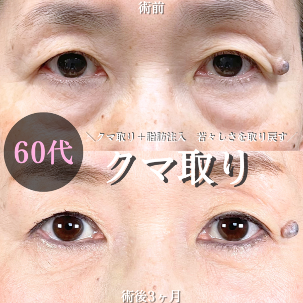 No.21027の症例写真