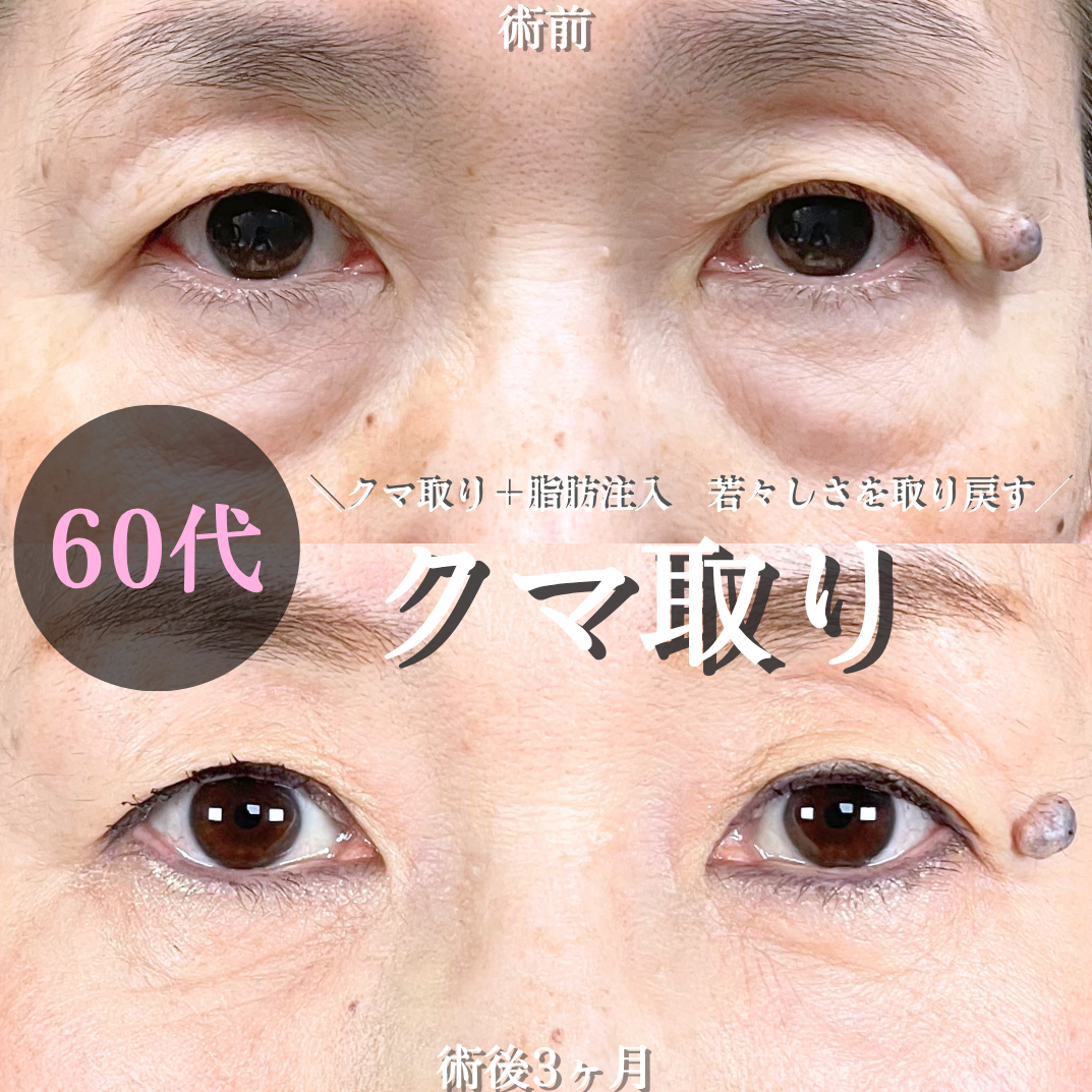 No.21027の症例写真