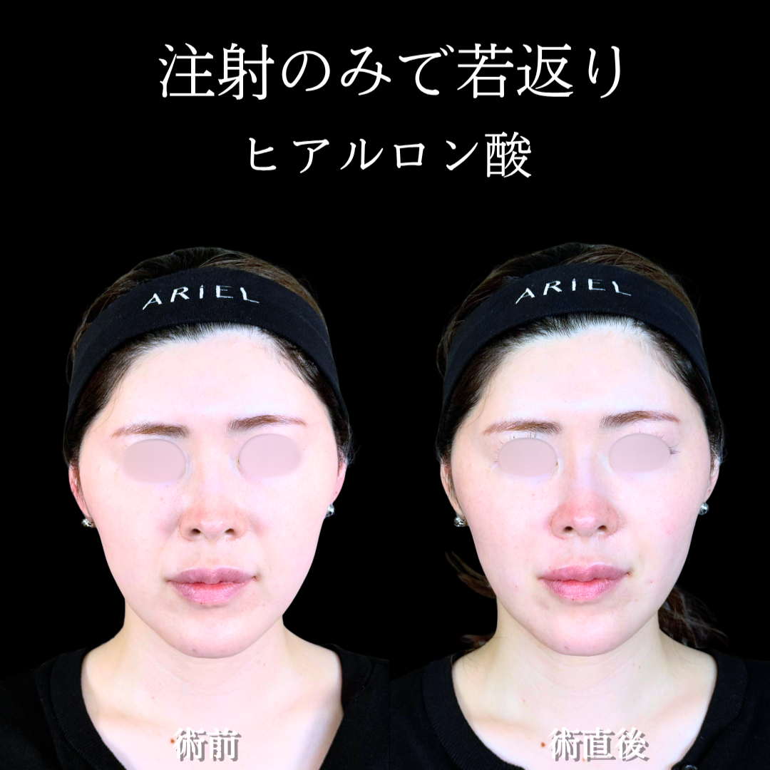 No.21034の症例写真